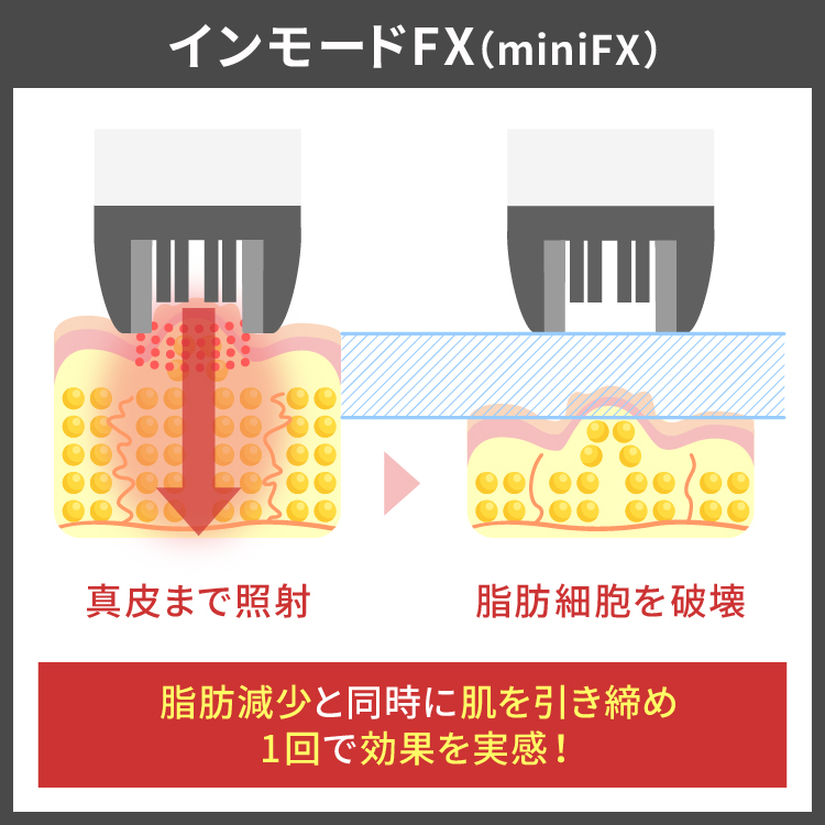 脂肪減少、肌のタイトニング効果・毛穴の改善が行える痩身機器です。