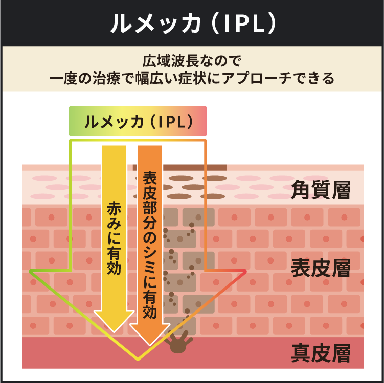 ルメッカ（IPL）