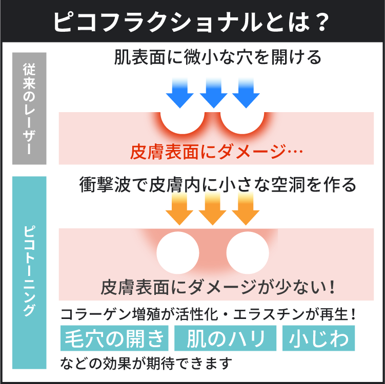 皮膚内に小さな空洞を作ることでコラーゲン増殖が活性化されエラスチンが再生します